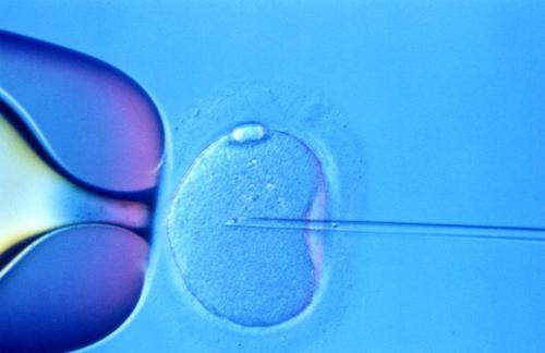 西安双胞胎二代试管婴儿-子宫肌瘤的诊断是什么？