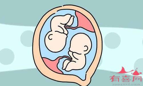 厦门合法供卵双胞胎-两个卵泡能产生双胞胎吗？