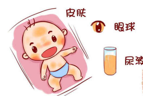 常德助孕中介生子-黄疸在新生儿中是正常的，下面是你在怀孕期间可以做的预防措施